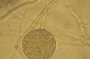 Bệnh do nấm Phytophthora palmivora trên sầu riêng và cách phòng trừ